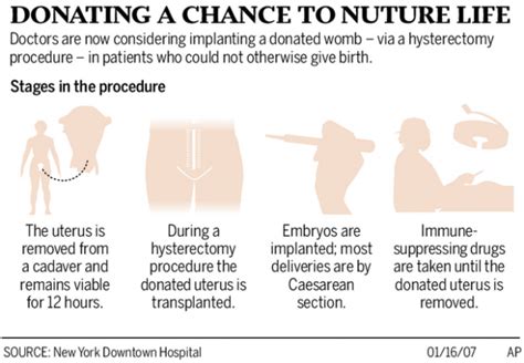 Uterus Transplant Plans Hold Hope For Barren Women