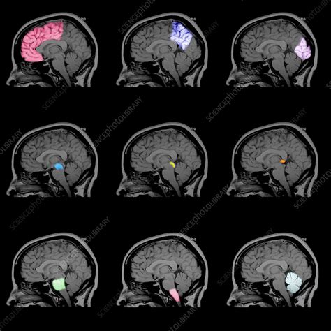 Composite Mri Showing Brain Regions Stock Image C0306305 Science