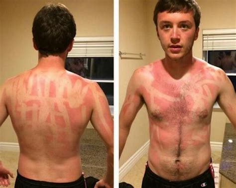 Epic Tanning Fails That Prove Some People Should Just Stay Indoors Page Of