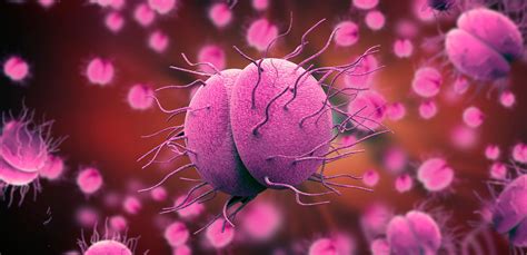 Gonorrhoea How Is It Caused And What Are The Possible Complications