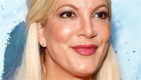 Did Tori Spelling Have Plastic Surgery Everything You Need To Know