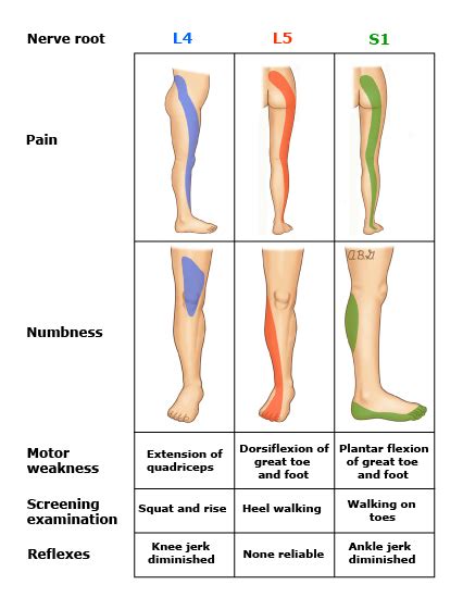 비특이적 요통 Nonspecific low back pain 과 특이적 요통의 감별 Latest updated 2019 06