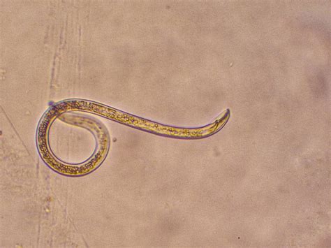 What Are Plant Parasitic Nematodes And Learn How To Management Them