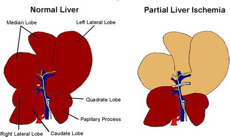 Figure 1 From Mouse Model Of Liver Ischemia And Reperfusion Injury