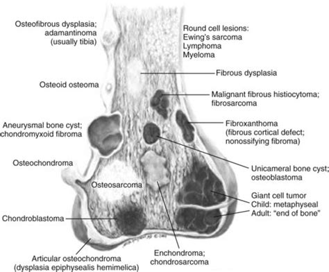 Orthopaedic Pathology Musculoskeletal Key