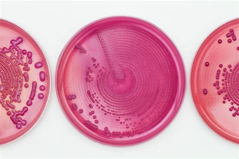 Bacteria Cultures In Macconkey Agar Photograph By Daniela Beckmann