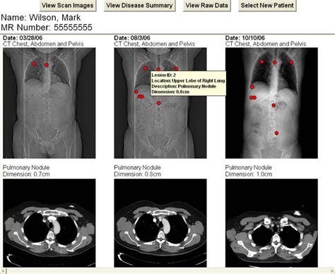 Anatomical Summary View With Three Ct Scans Of The Chest Abdomen And