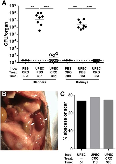 Renal Scars Develop Following Durably Successful Cro Treatment Male