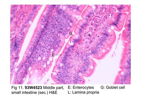 Block10 1fig 11 93w4523 Middle Part Small Intestine Sec Hande