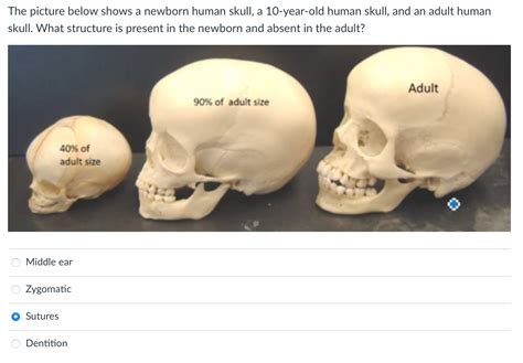 Solved The Picture Below Shows A Newborn Human Skull A
