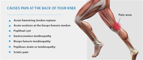 Getting To The Source Of Bent Knee Pain