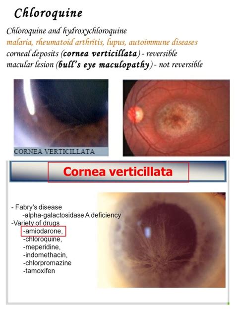 Maculopapular Lesions Are Best Described As