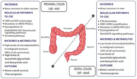 Metabolites Free Full Text Colon Cancer From Epidemiology To Prevention