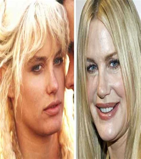 Worst Cases Of Celebrity Plastic Surgery Gone Wrong E