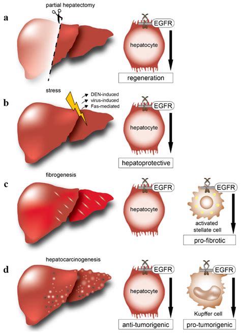 Ijms Free Full Text Egfr Signaling In Liver Diseases Html