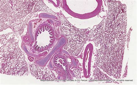 Bronchi Respiratory System Anatomy Tissue Biology His