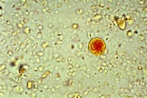 Entamoeba Histolytica Cyst Photograph by Science Source