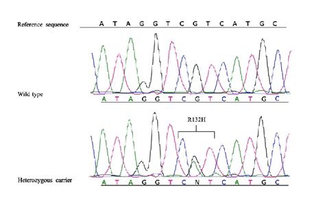 Sanger Sequencing Analysis Of An Idh1 R132h Heterozygous Patient Download Scientific Diagram