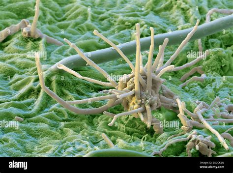 Grey Mould Scanning Electron Micrograph Sem Of A Grey Mould