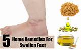 Swollen Kidney Home Remedies Pictures