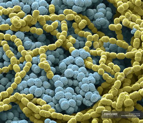 Scanning Electron Micrograph Of Bacterial Culture From Sputum