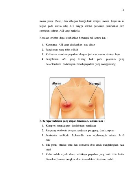 Gambar Perawatan Payudara Pada Ibu Hamil Jawaban Buku