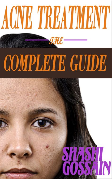 The Complete Guide To Acne Treatments Pharmaclinix