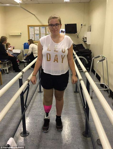 Dorset Woman Paid £5k To Have Her Leg Amputated After Nhs Refused Daily Mail Online
