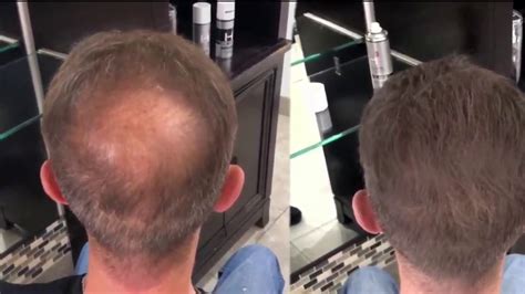 Toppik Hair Fiber Vs Haircubed3 Amazing Video Thinning Hair In The