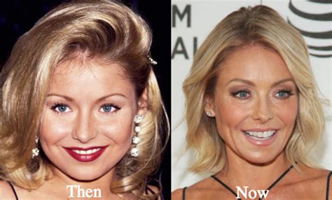 Kelly Ripa Plastic Surgery Before And After Photos Latest Plastic