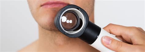 Mole Monitoring And Removal Clayton Dermatology