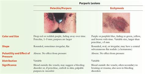 Purpuric Skin Lesions Petechia Purpura And Ecchymosis Grepmed