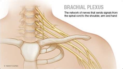 Mayo Clinic Minute Surgical Options To Treat Brachial Plexus Injuries