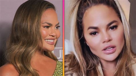 Chrissy Teigen Reveals Cosmetic Surgery On Her Face Youtube