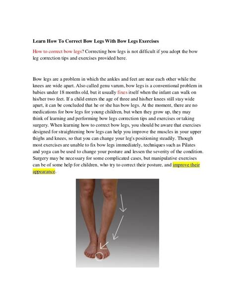 Learn How To Correct Bow Legs With Bow Legs Exercises