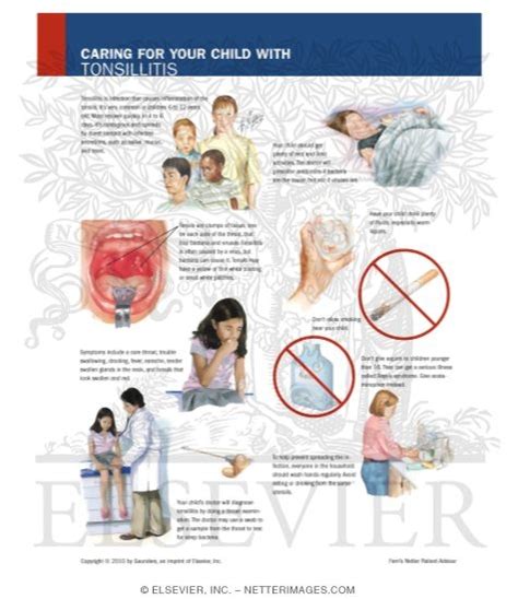 Caring For Your Child With Tonsillitis