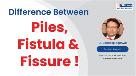 Difference Between Piles Fistula And Fissure Gmoney Health Show