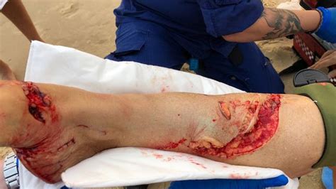 Great White Shark Attacks Woman In Botany Bay The Courier Mail