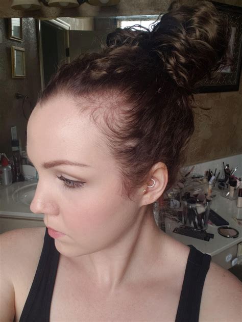 How Can I Help Or Fix A Receding Hairline 31f Haircuts For