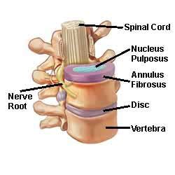 Potom Mu Edn K Poslucha Stages Of Disc Herniation Za Ob As P Ibl En