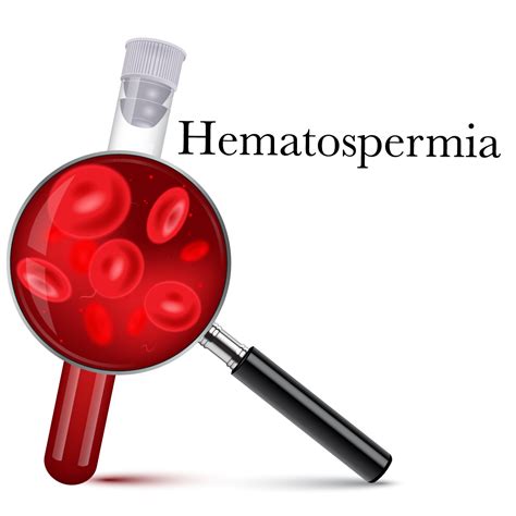 Hematospermia Blood In Semen Causes Symptoms And Treatment