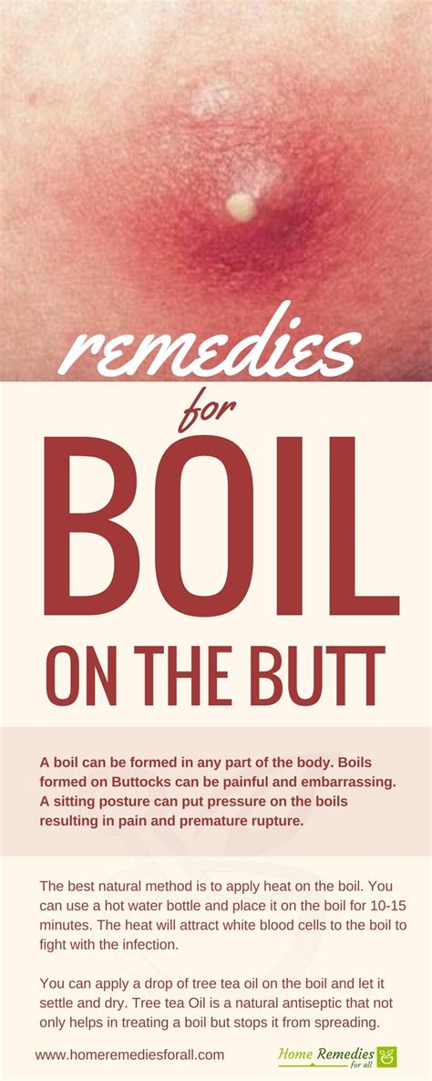 Effective Home Remedies To Get Rid Of Boil Youtube