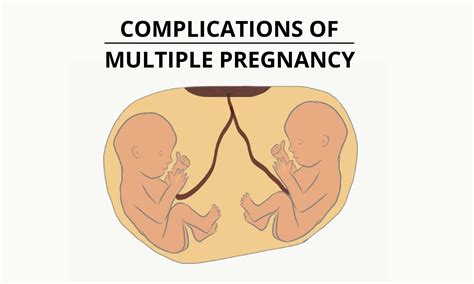 Main 10 Complications Of Multiple Pregnancy Pro Doctor