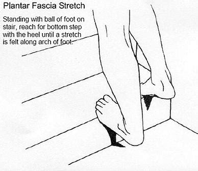 Plantar fasciitis causes pain around the heel, arch and bottom of the foot. Plantar Fasciitis - Foot Store