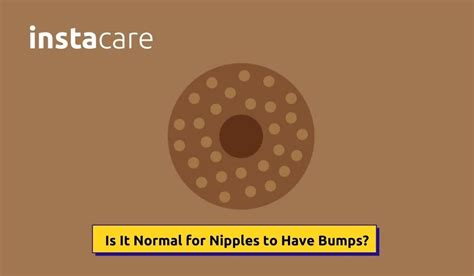 Is It Normal For Nipples To Have Bumps InstaCare