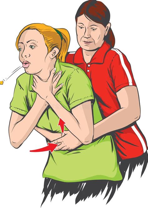 Heimlich Maneuver On Adult Stock Vector Illustration Of Isolated 9335852