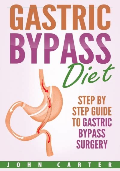 Pdf Gastric Bypass Diet Step By Step Guide To Gastric Bypass Surgery Gastric Bypass Cookbook