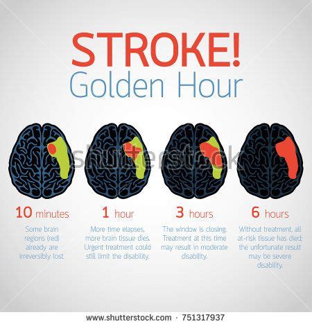 Stroke Golden Hour Infographic Vector Logo Icon Illustration