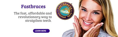 fast braces teeth straightening palms dentist shirley christchurch dentists