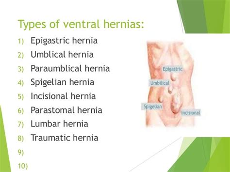 Ventral Hernias